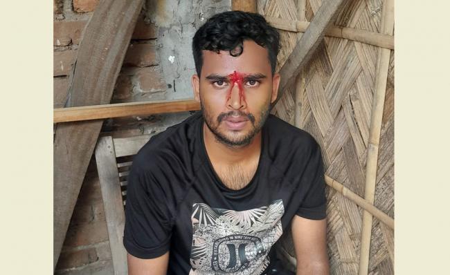 গুলিবিদ্ধ জুলাই যোদ্ধা আতিকুর রহমান উজ্জল